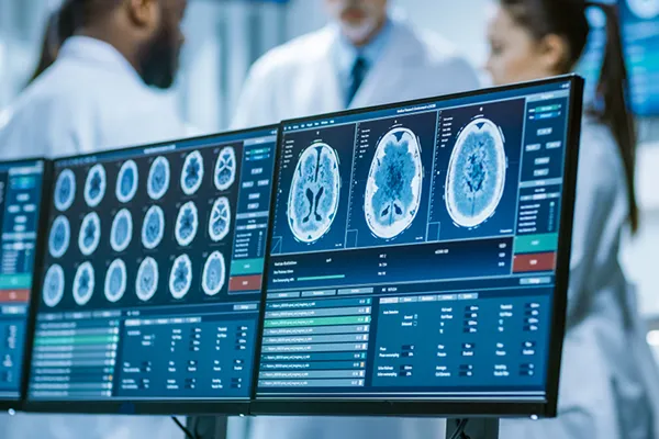 Brain MRI