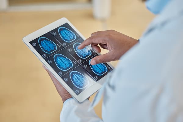 An MRI technician reviews a tablet full of scans of a patient's brain.