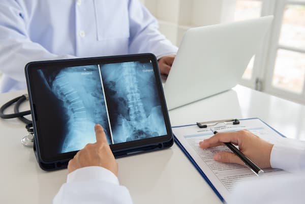 A doctor points out an element of a spine MRI.