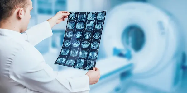 A technician looks at a series of images created by a Rock Hill MRI scan.